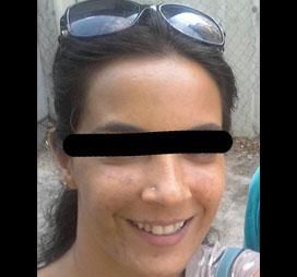 מקרה 11, לפני