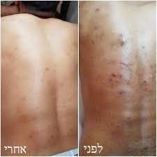 מקרה 15, לפני