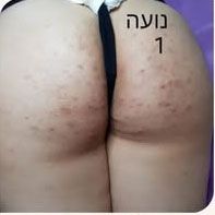 מקרה 22, לפני